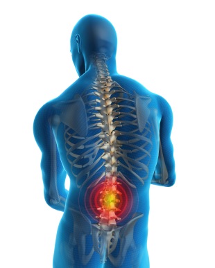 Epidural steroid injections for back pain