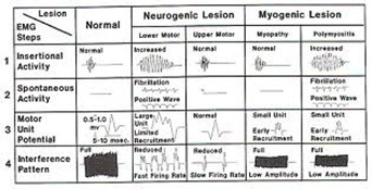 emg nerve test for back pain emg nerve test for back pain