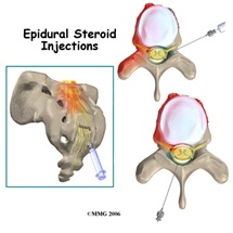 Best-Epidural-Doctor-NYC-3