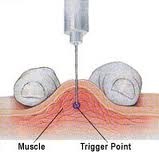 Best Pain Management Doctor NYC2