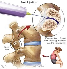 BestPainDoctorNYC2 BestPainDoctorNYC2