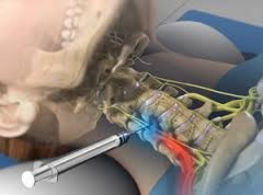 BestPainDoctorNYC3