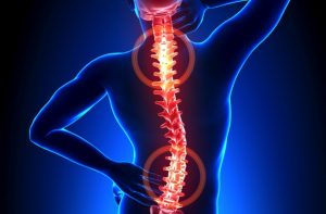 back_pain-209266eeb85aceecdb900cc8d5899587