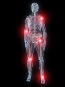 img-neuropathicpain-png-fw_-225x300