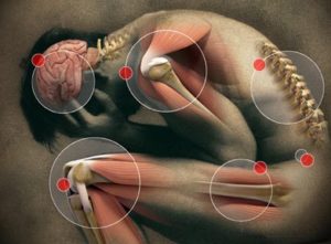 What Can a Pain Doctor Do for You?