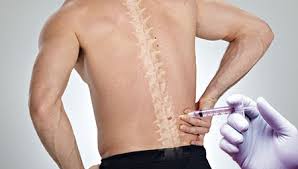 nyc-top-doctor-for-thoracic-epidural-steroid-injections-01