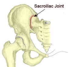 sacroiliac-joint-pain-expert-info-02