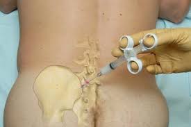 sacroiliac-joint-pain-injections-expert-doctor-03
