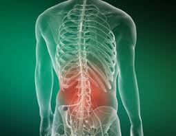 spinal-cord-stimulator-back-pain-nyc-specialist-03