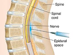pain-relief-lumbar-region-description-faq-info-03