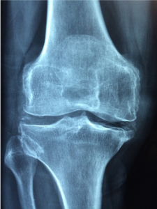 Top Pain Management Specialist New York