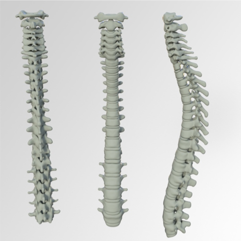 spinal injections for pain