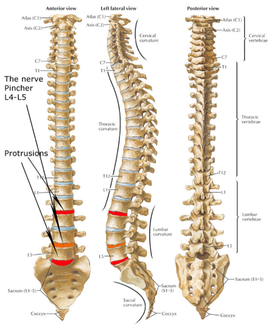 Sciatic nerve pain - spinal diagram nerves