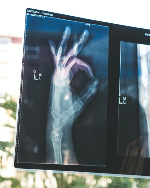 Best Doctor for Major Types of Pain NYC